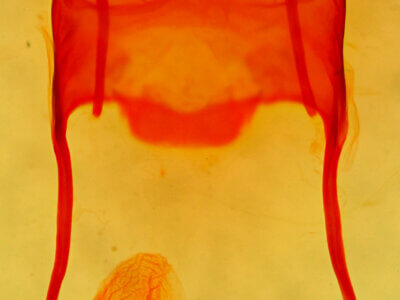 genitalia view of adult Archanara geminipuncta