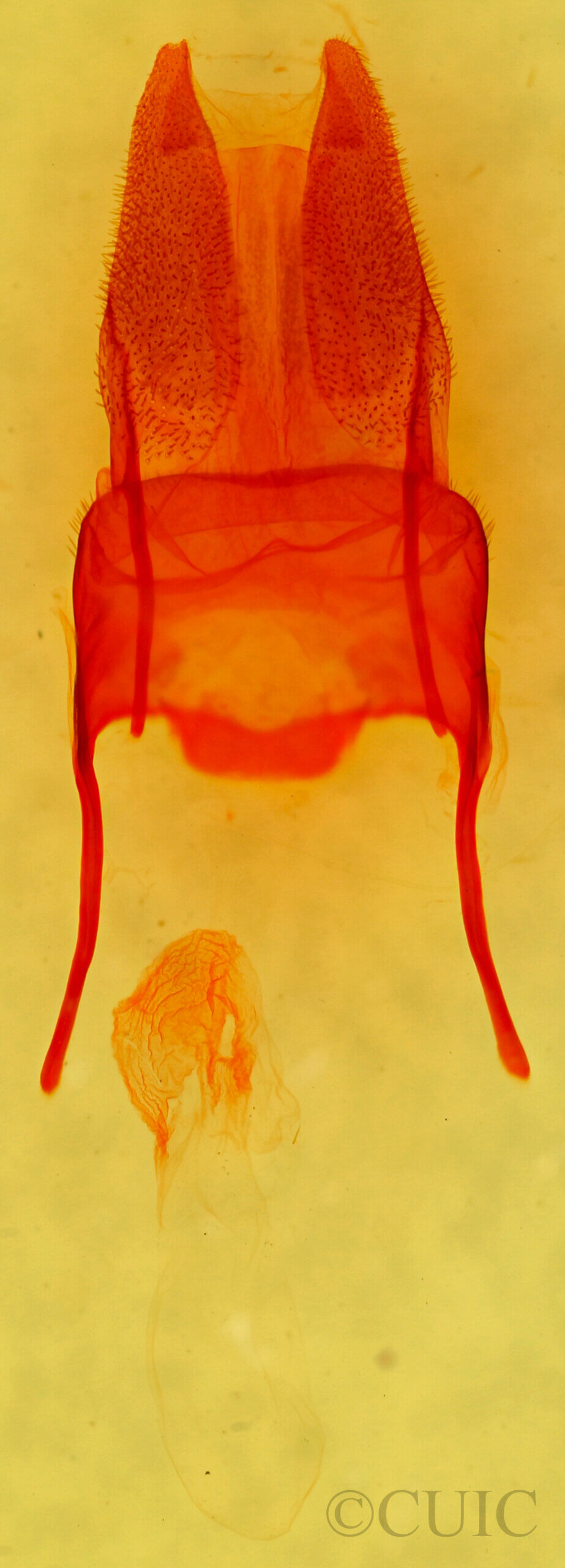 genitalia view of adult Archanara geminipuncta