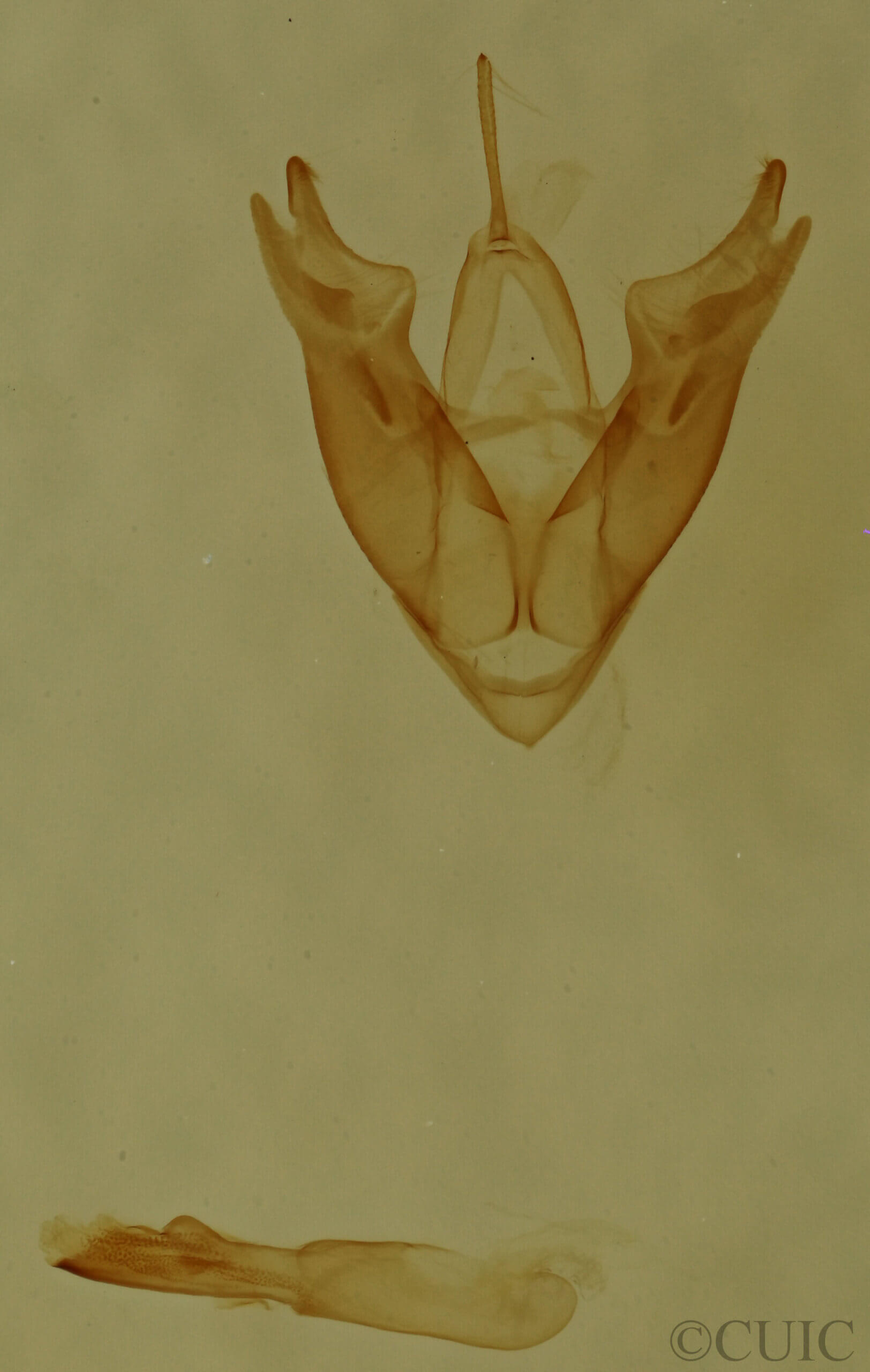 genitalia view of adult Hyperstrotia sp.