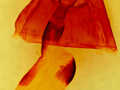 genitalia view of adult Caenurgina sp.