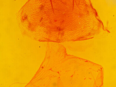 genitalia view of adult Paramiana sp.