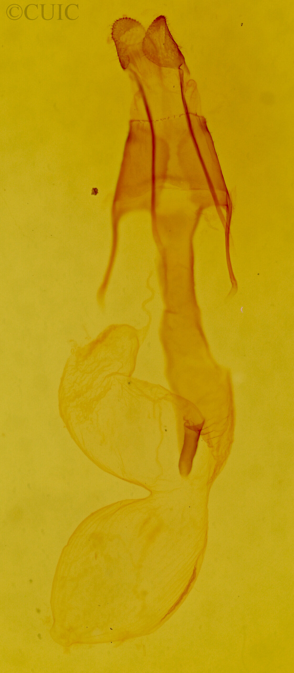 genitalia view of adult Lasionycta sp.
