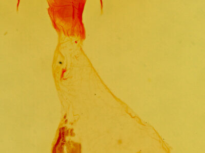 genitalia view of adult Bryolymnia viridata