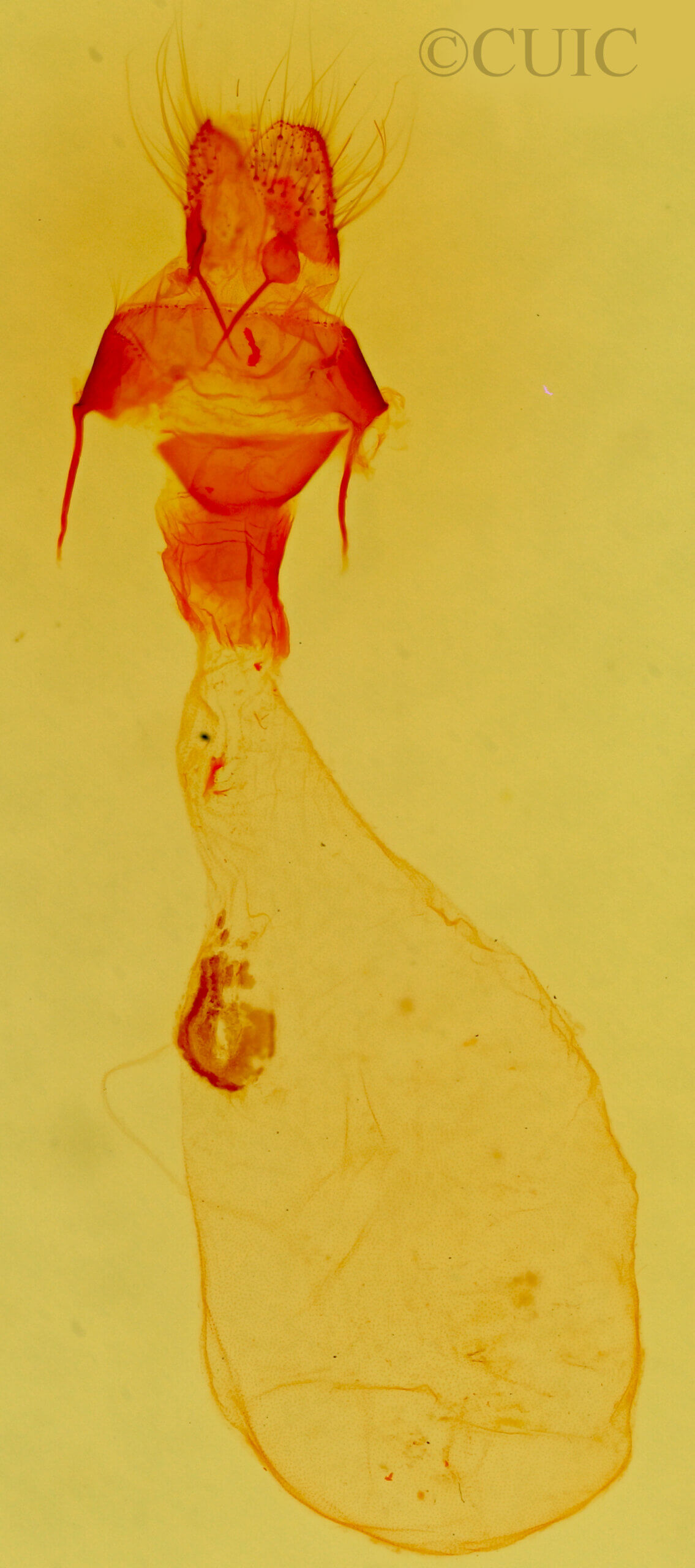 genitalia view of adult Bryolymnia viridata