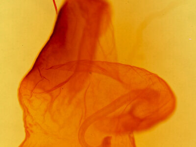 genitalia view of adult Acronicta fallax