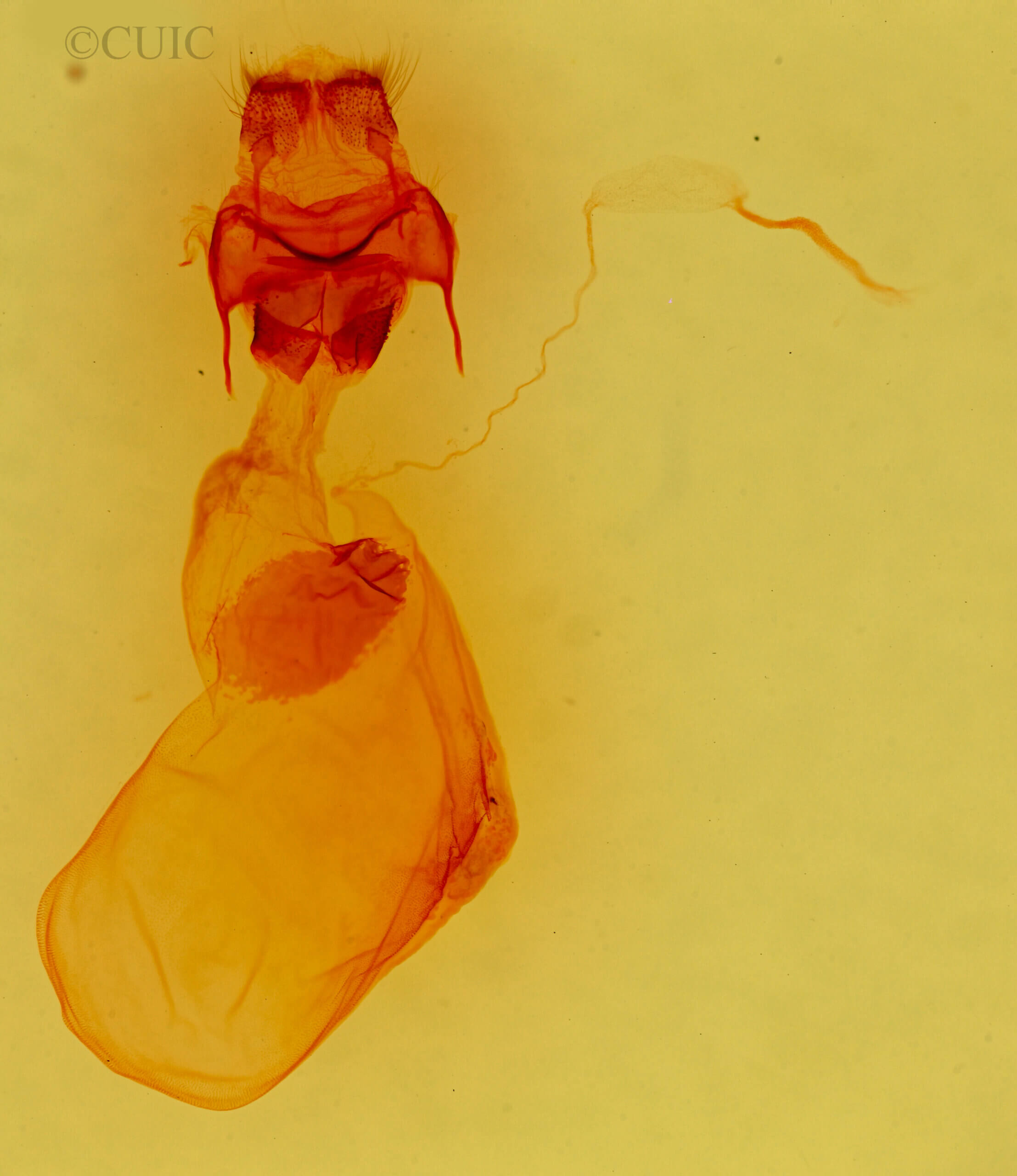 genitalia view of adult Chloronycta tybo
