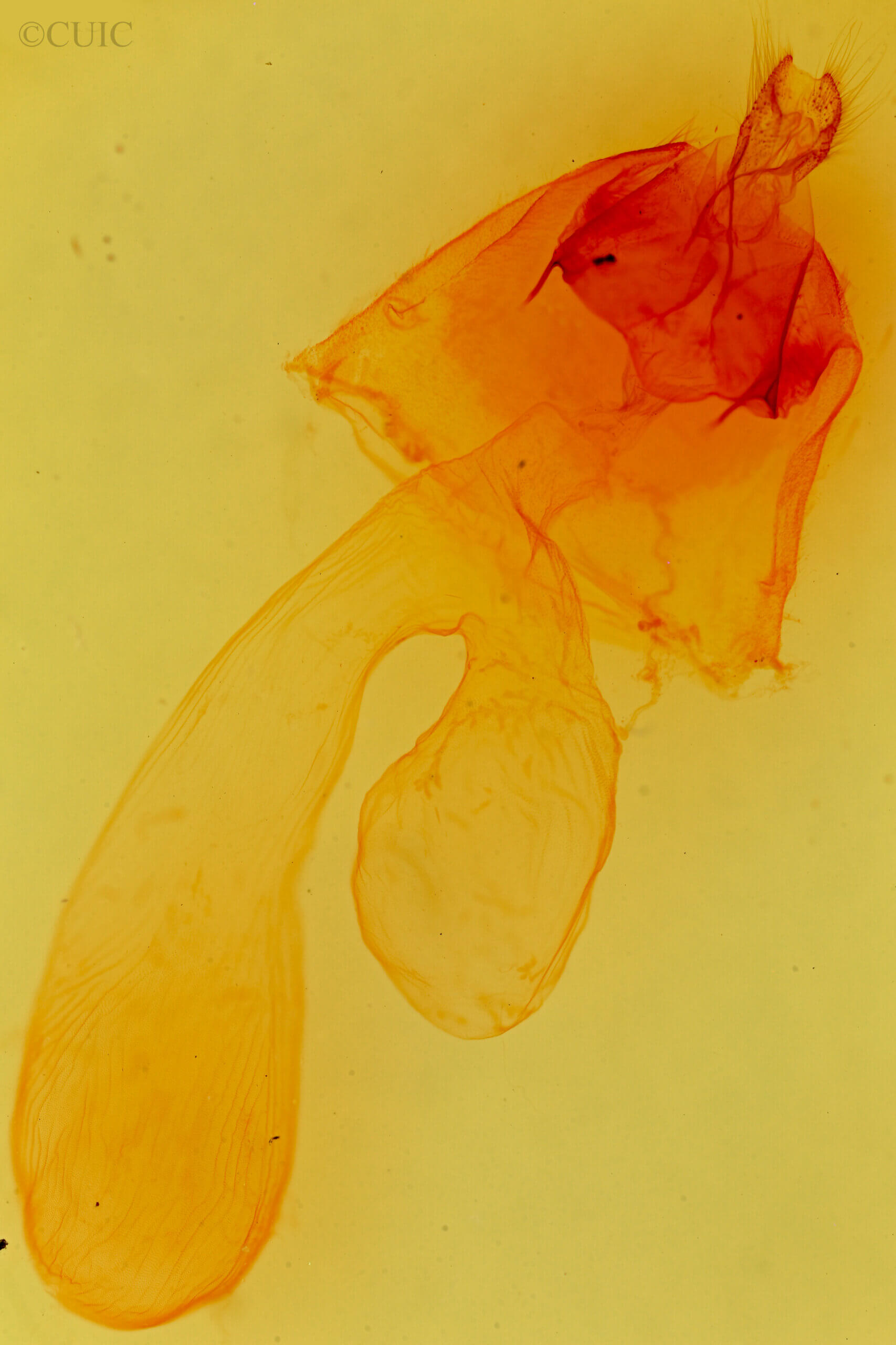 genitalia view of adult Dichagyris madida