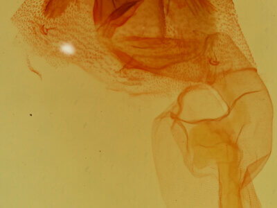 genitalia view of adult Amiana niama