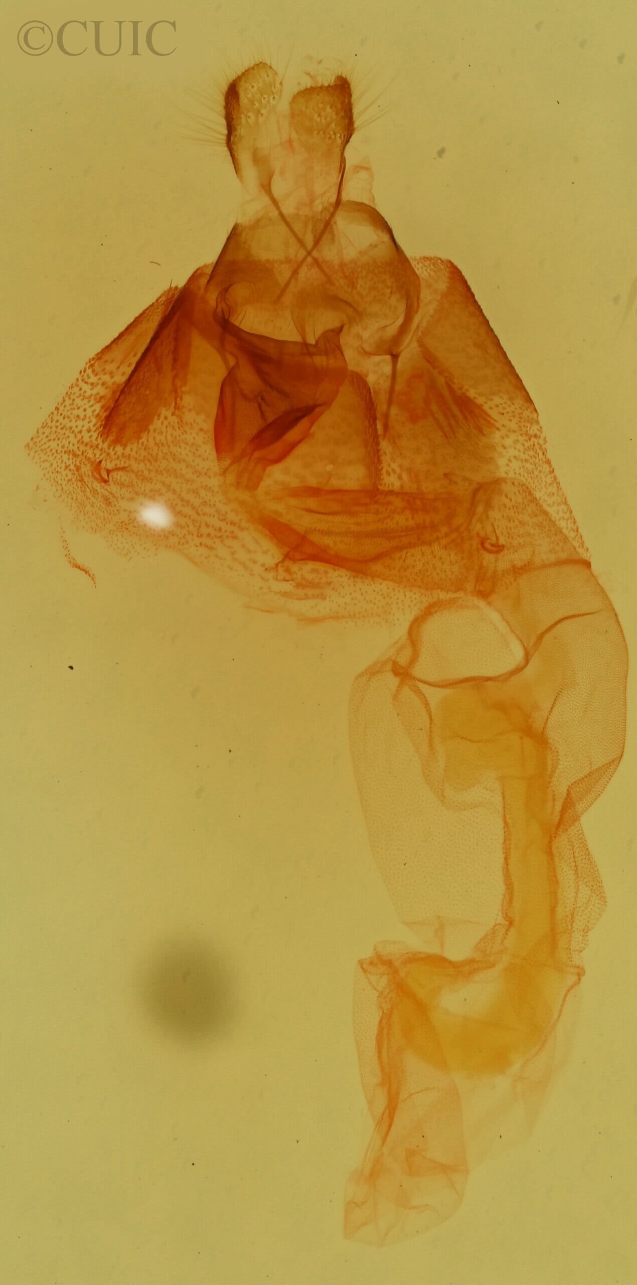 genitalia view of adult Amiana niama