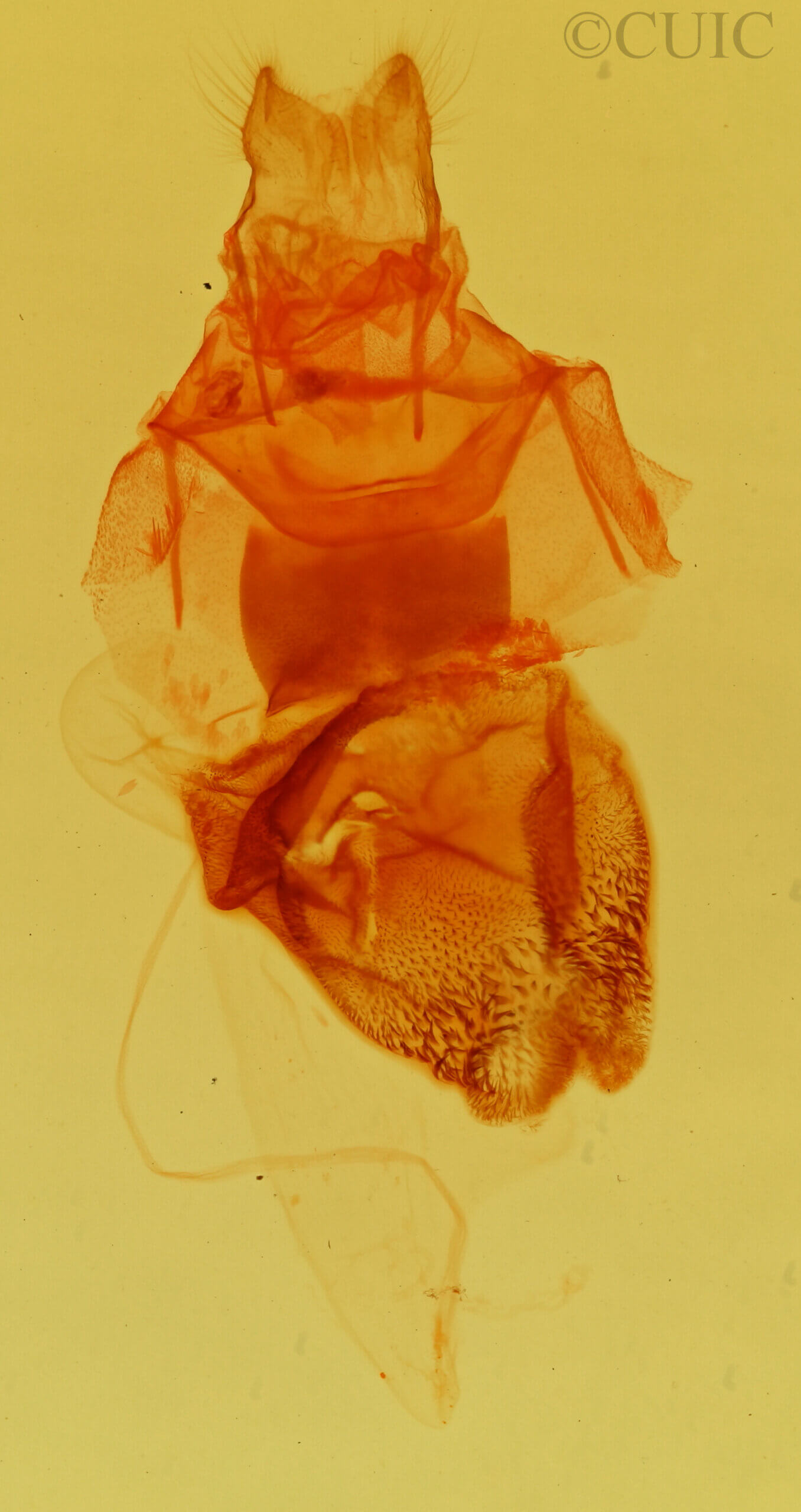 genitalia view of adult Paraeuchaetes insulata