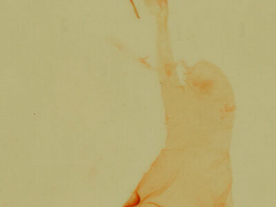 genitalia view of adult Cobubatha dividua