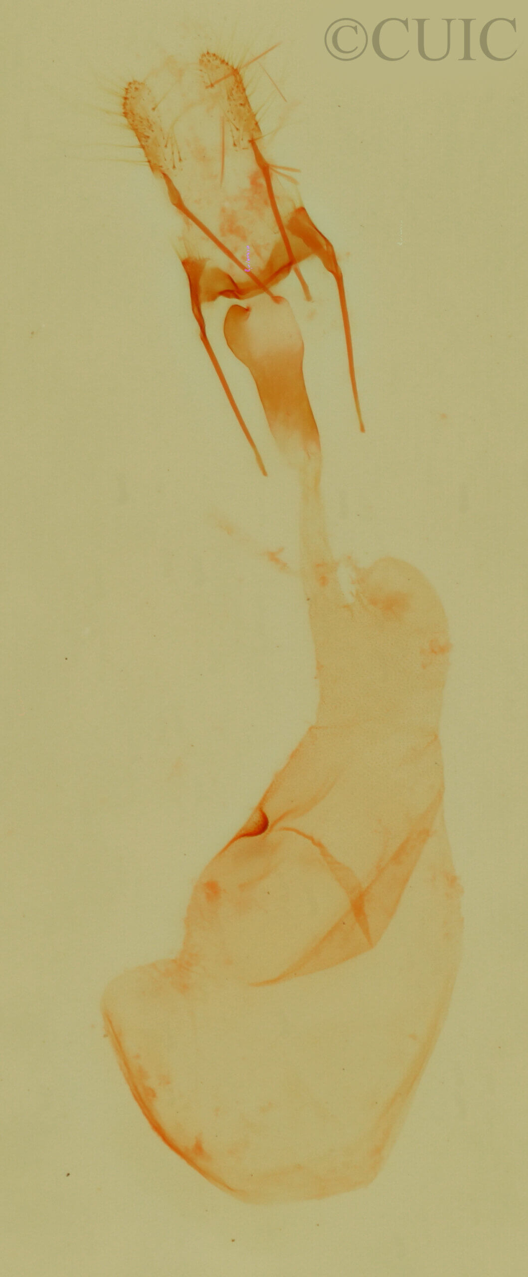 genitalia view of adult Cobubatha dividua