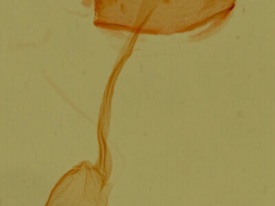 genitalia view of adult Ozarba sp.