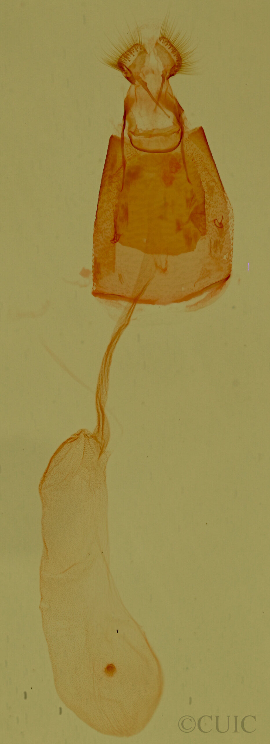 genitalia view of adult Ozarba sp.