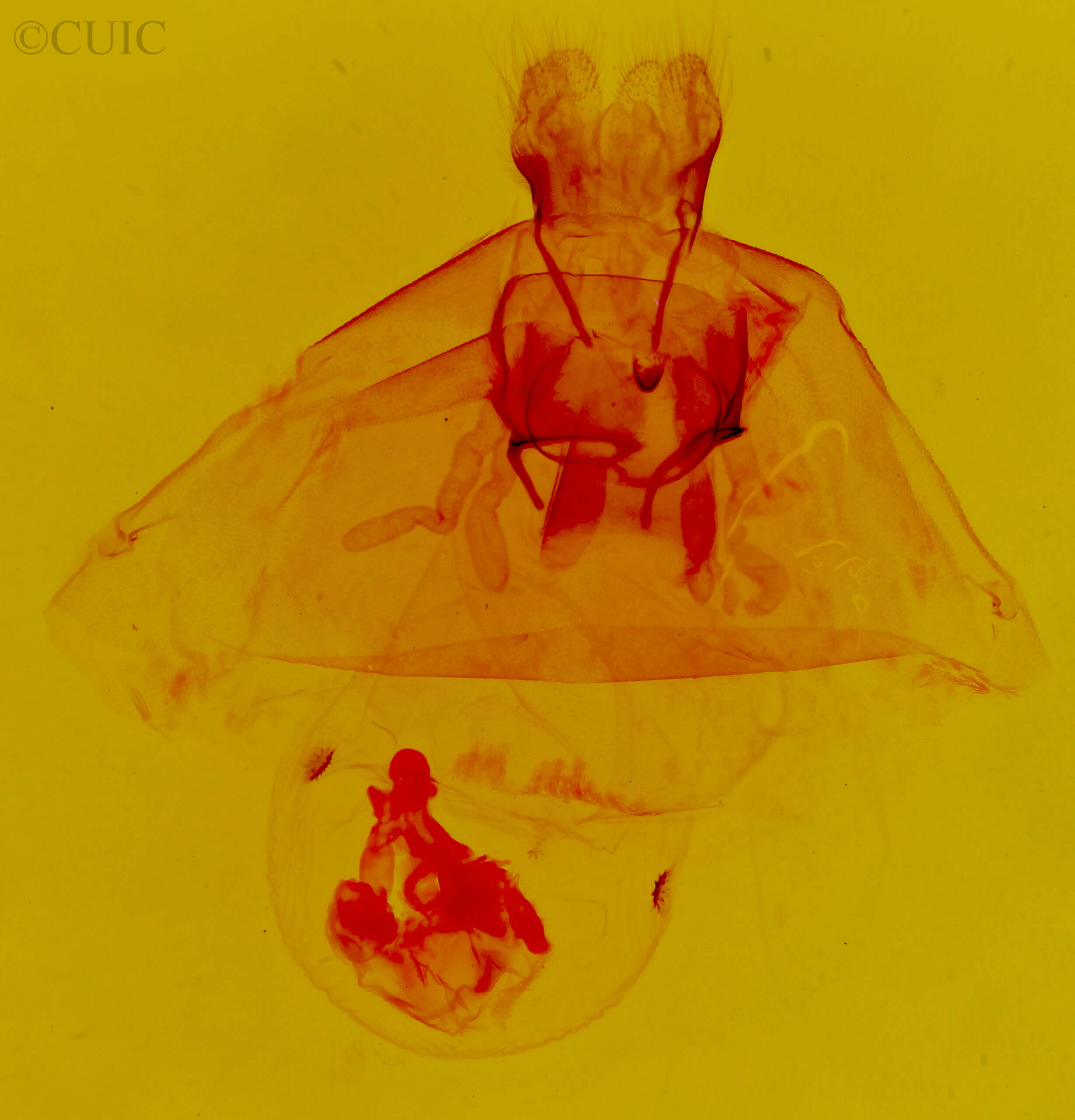 genitalia view of adult Hypercompe permaculata