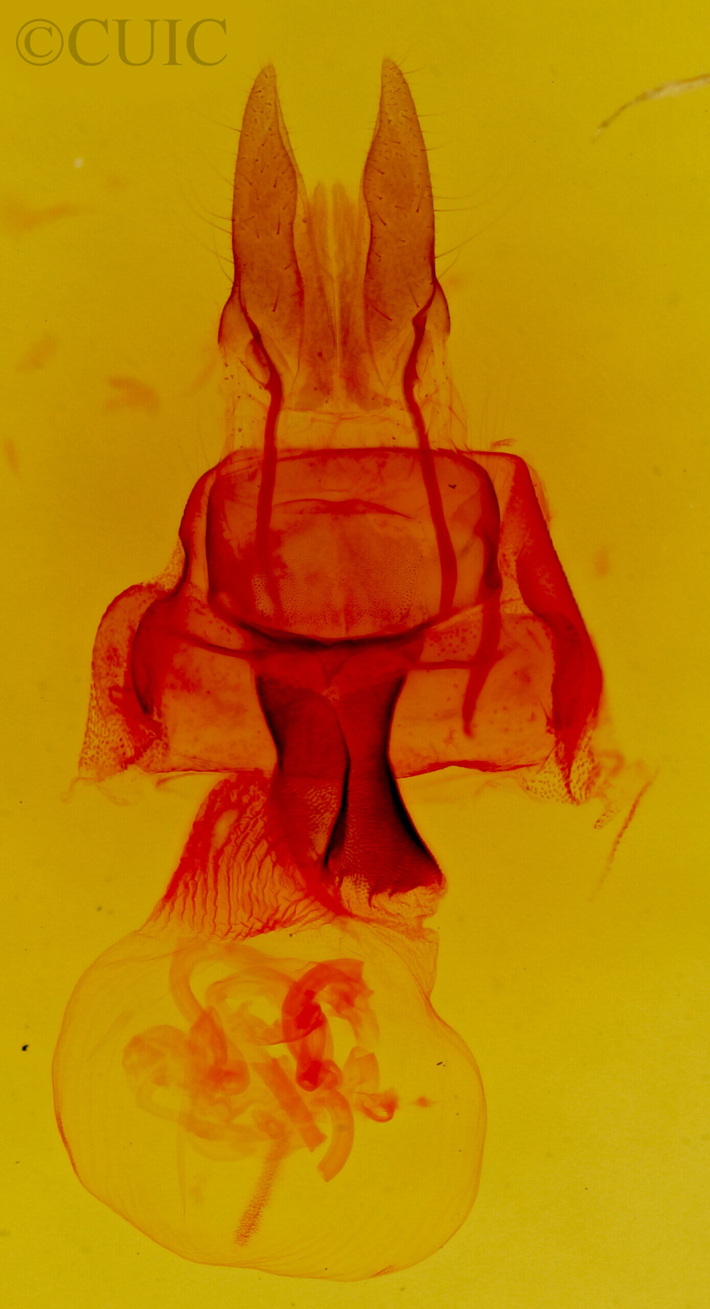 genitalia view of adult Neoligia crytora