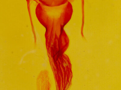 genitalia view of adult Oligia strigilis