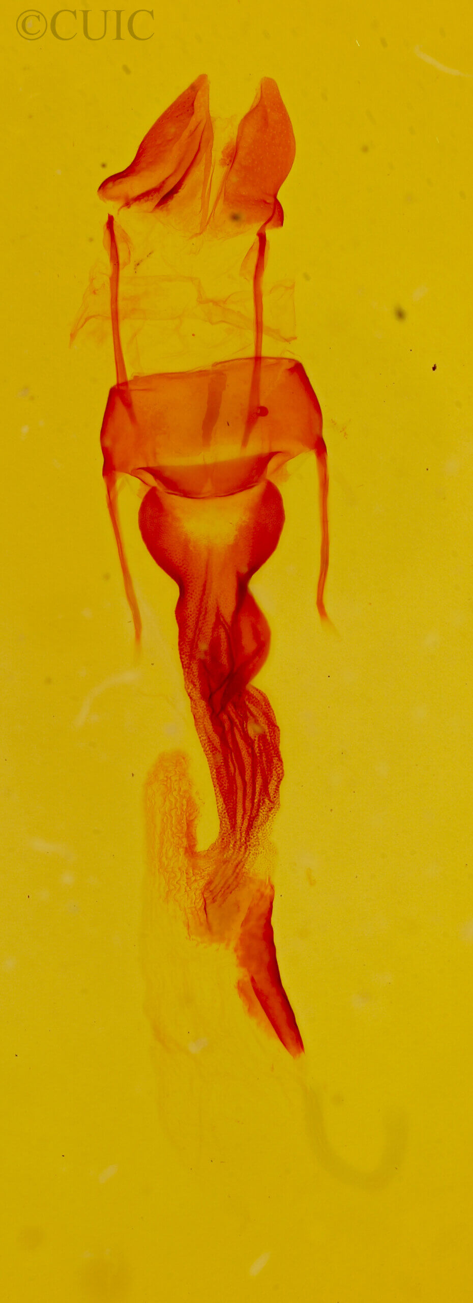 genitalia view of adult Oligia strigilis