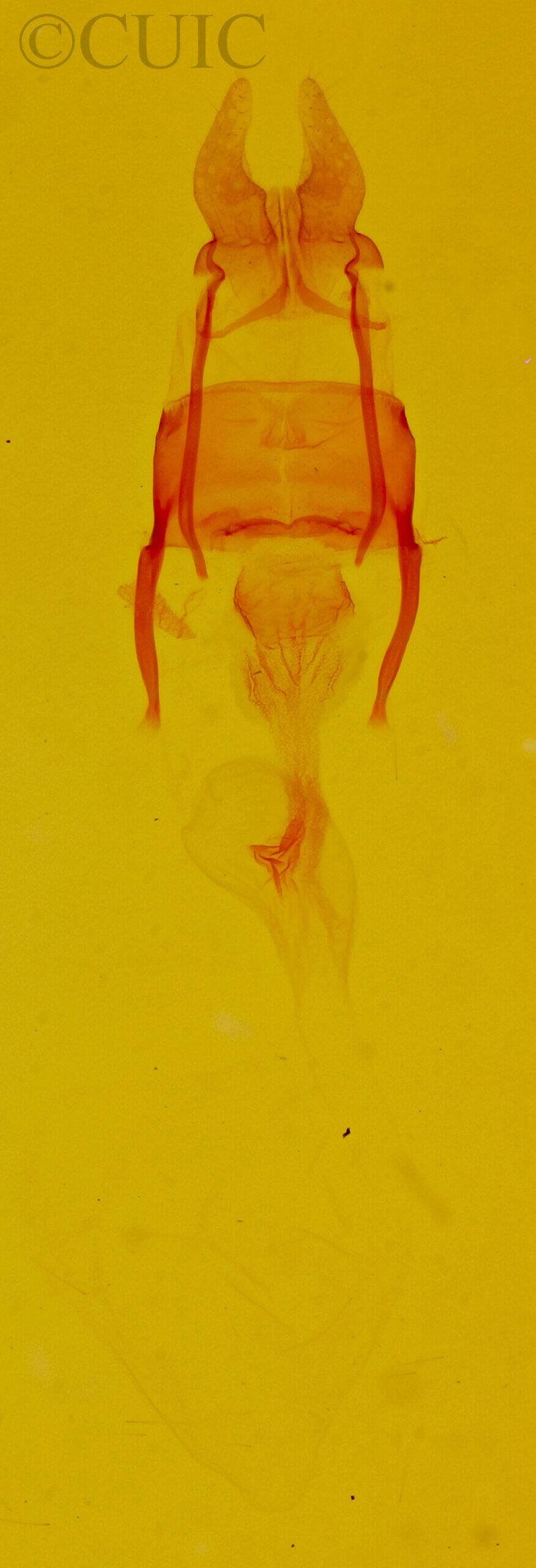 genitalia view of adult Mesoligia furuncula