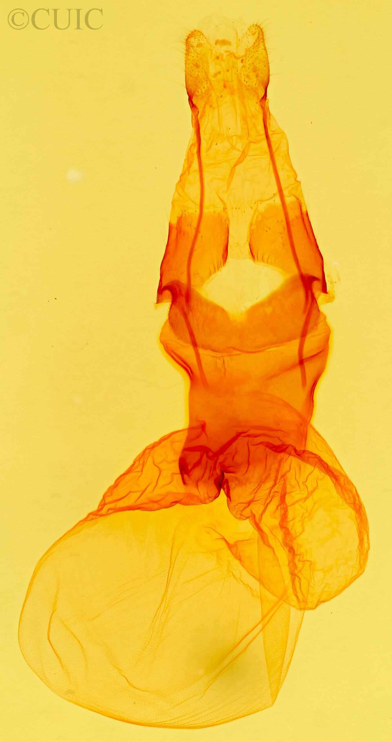genitalia view of adult Protoperigea posticata