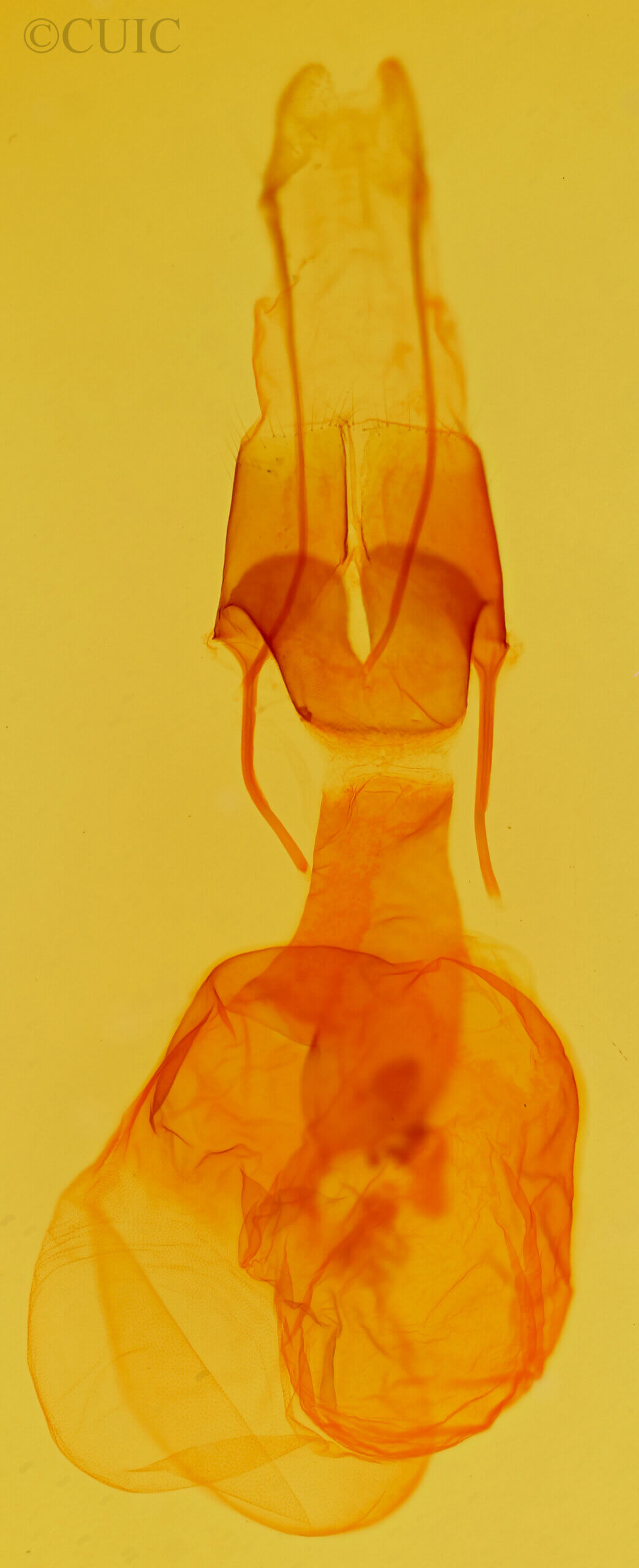 genitalia view of adult Protoperigea posticata