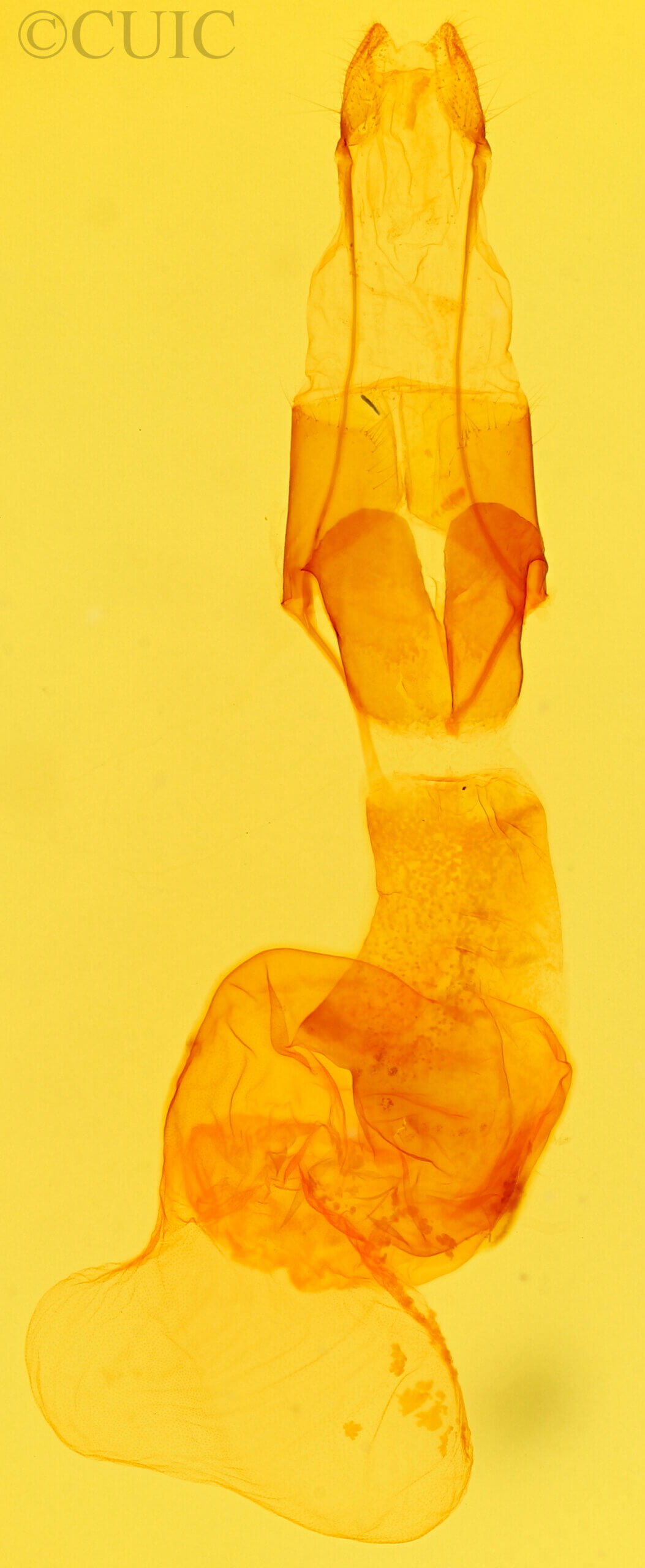 genitalia view of adult Protoperigea posticata