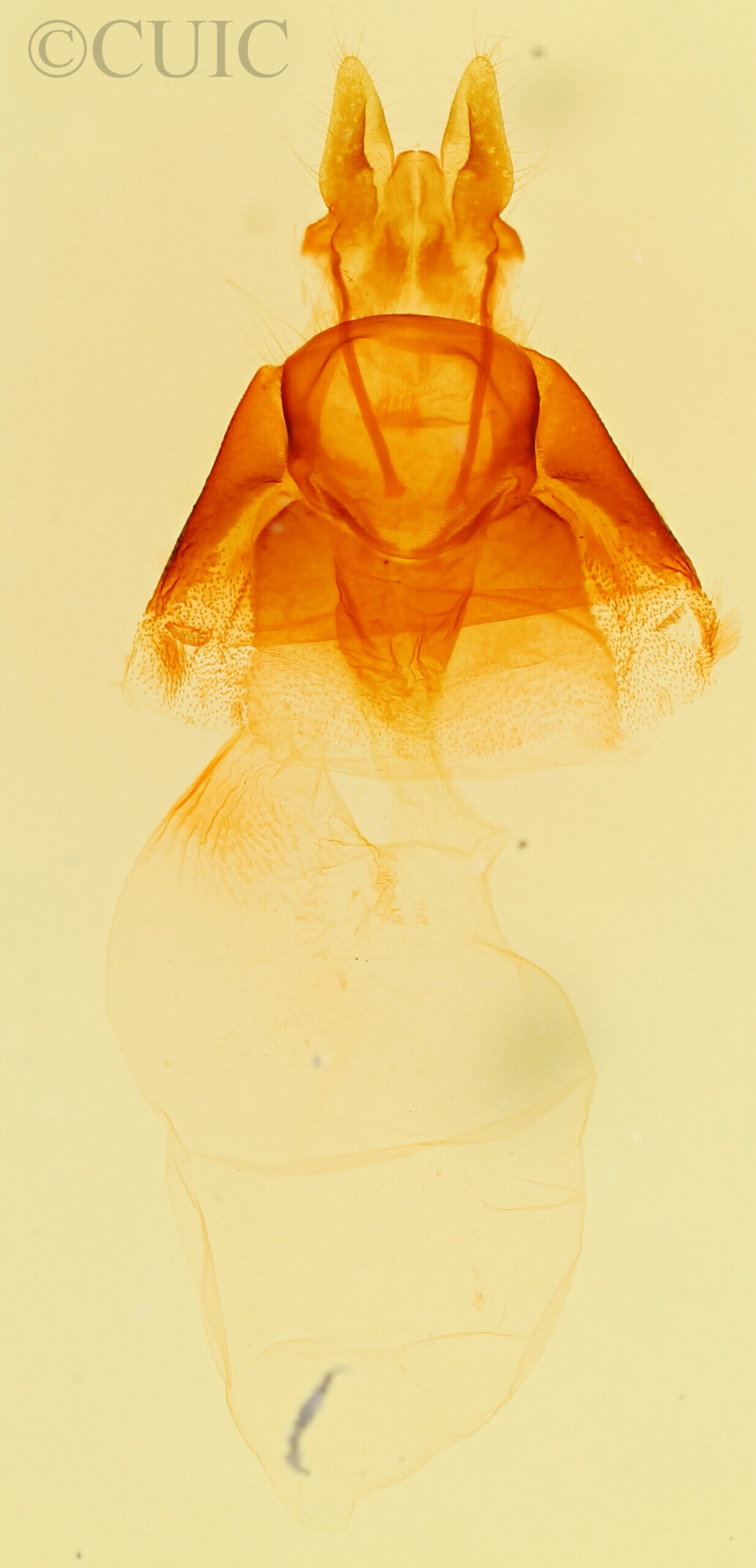 genitalia view of adult Mesapamea fractilinea albescens