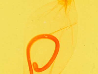 genitalia view of adult Azeta sp.