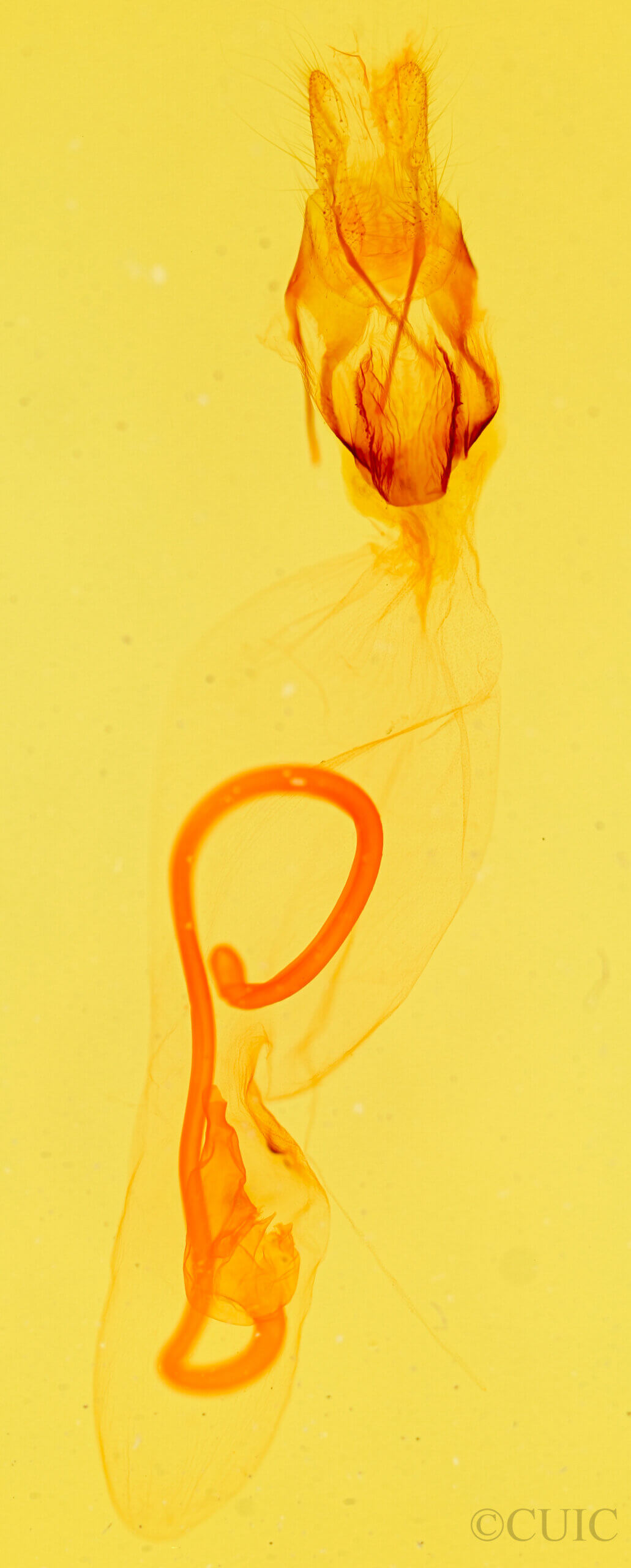 genitalia view of adult Azeta sp.