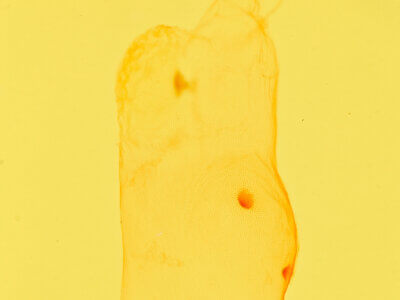 genitalia view of adult Azeta sp.