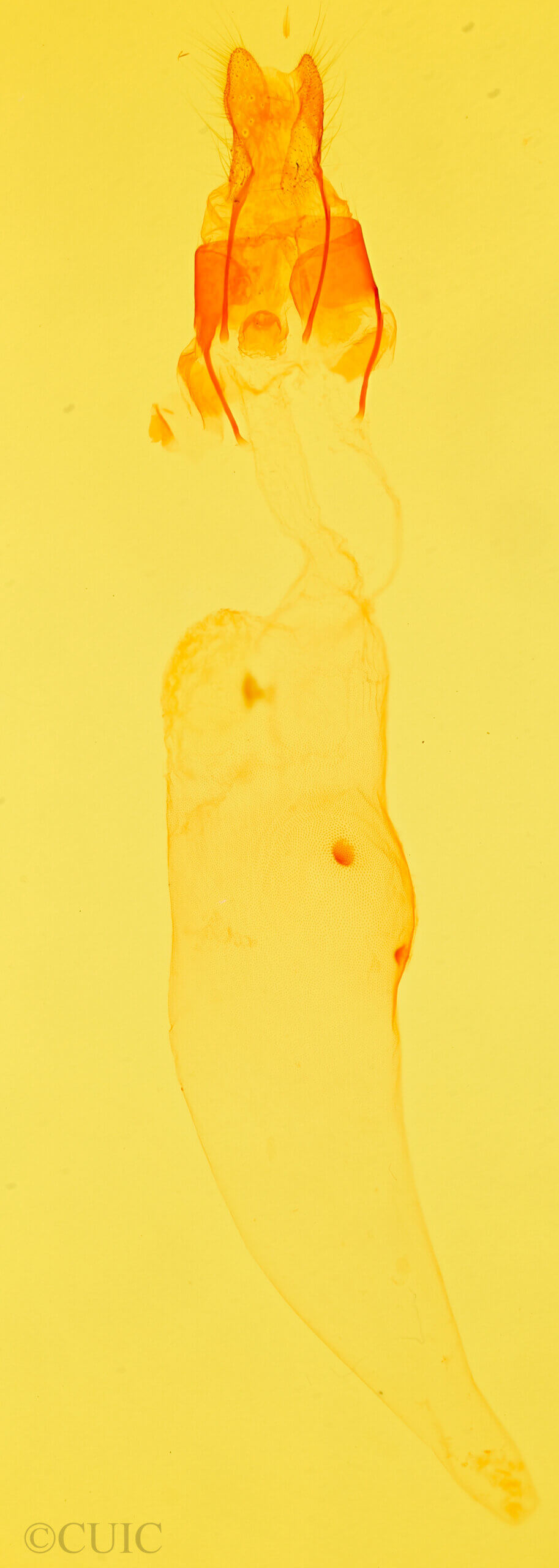 genitalia view of adult Azeta sp.
