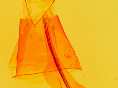 genitalia view of adult Anticarsia sp.