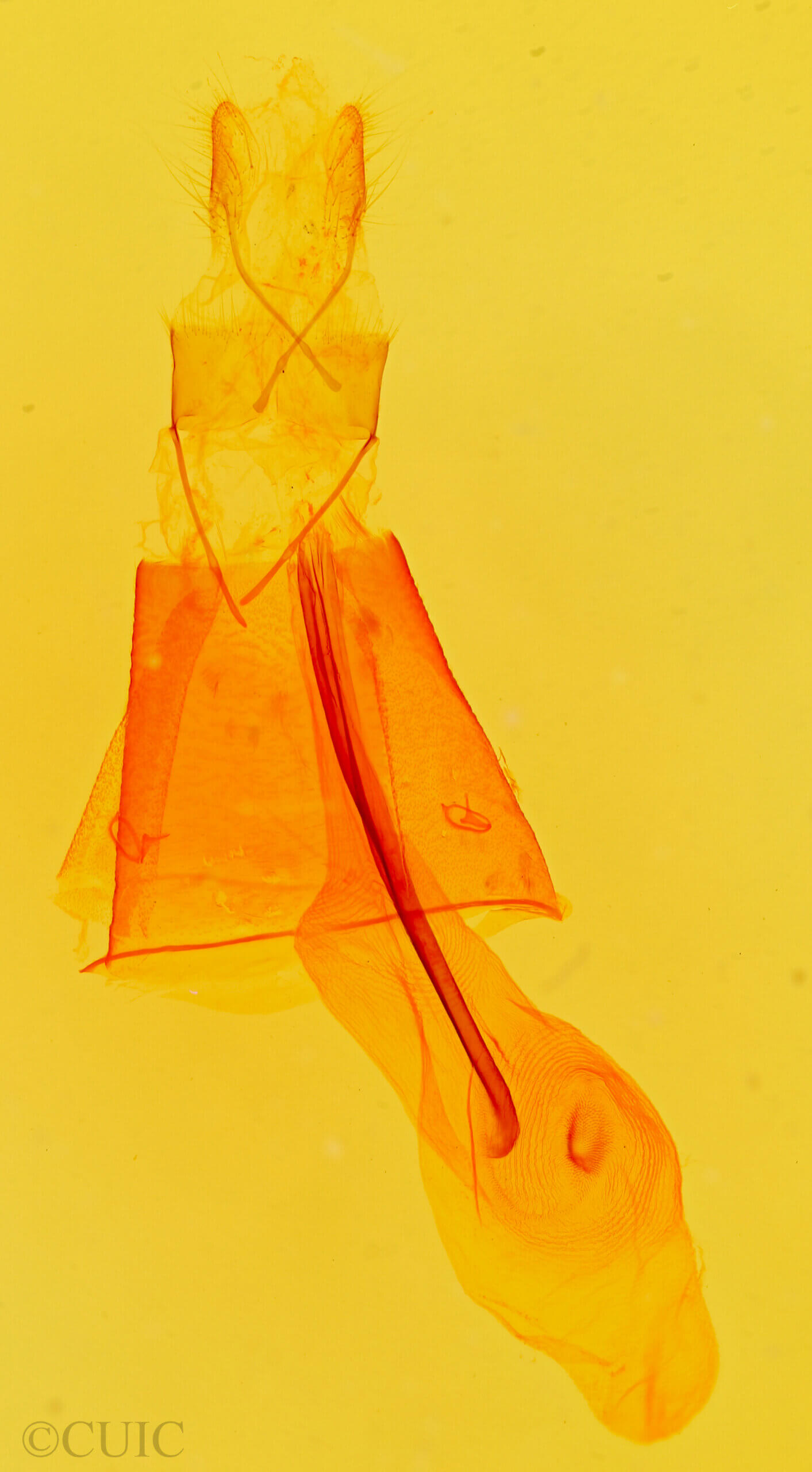 genitalia view of adult Anticarsia sp.