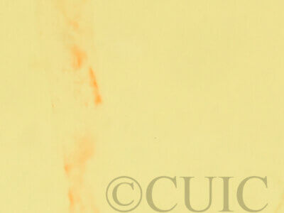 genitalia view of adult Metallata absumens