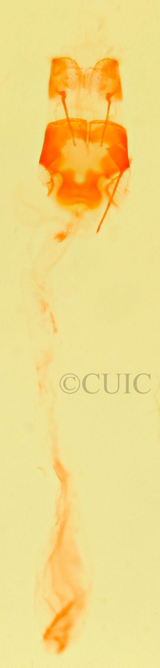 genitalia view of adult Metallata absumens