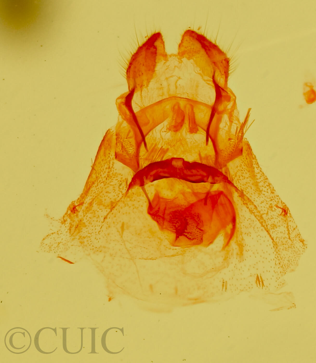 genitalia view of adult Pagara simplex