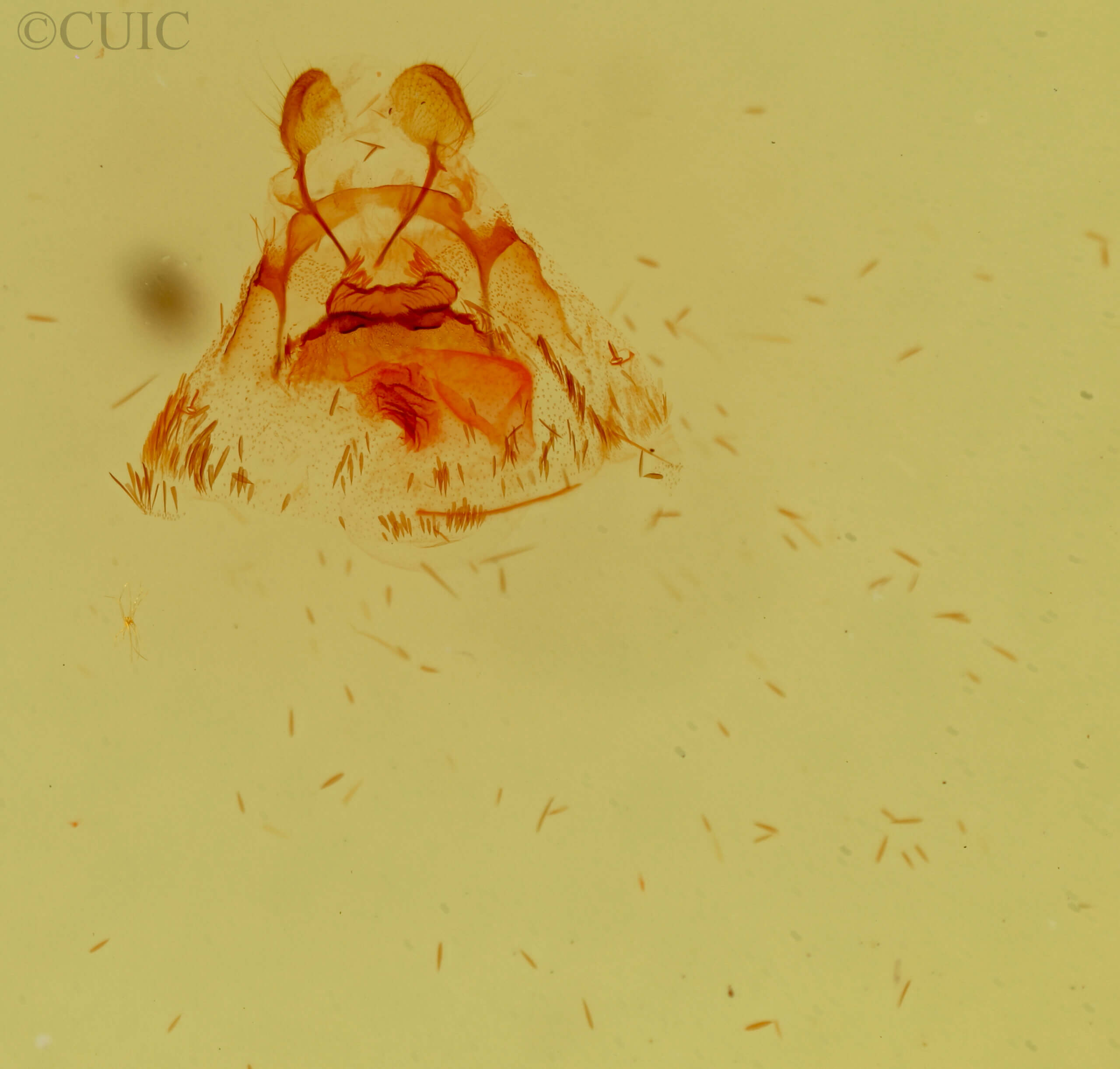 genitalia view of adult Pagara simplex