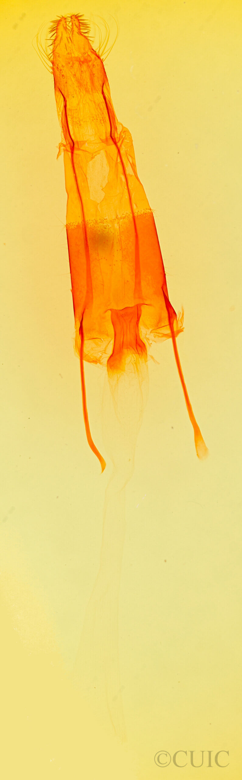 genitalia view of adult Enargia infumata