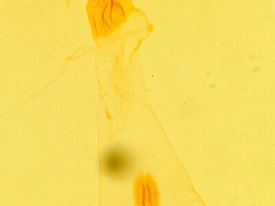 genitalia view of adult Condica vecors