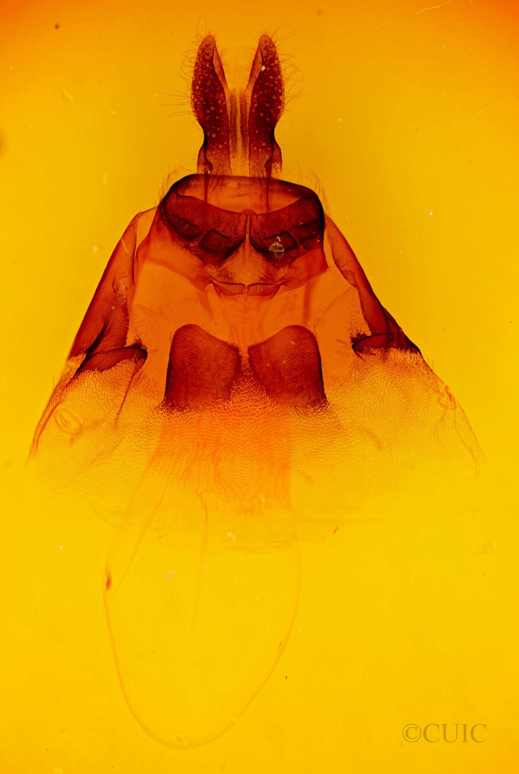 genitalia view of adult Macronoctua onusta