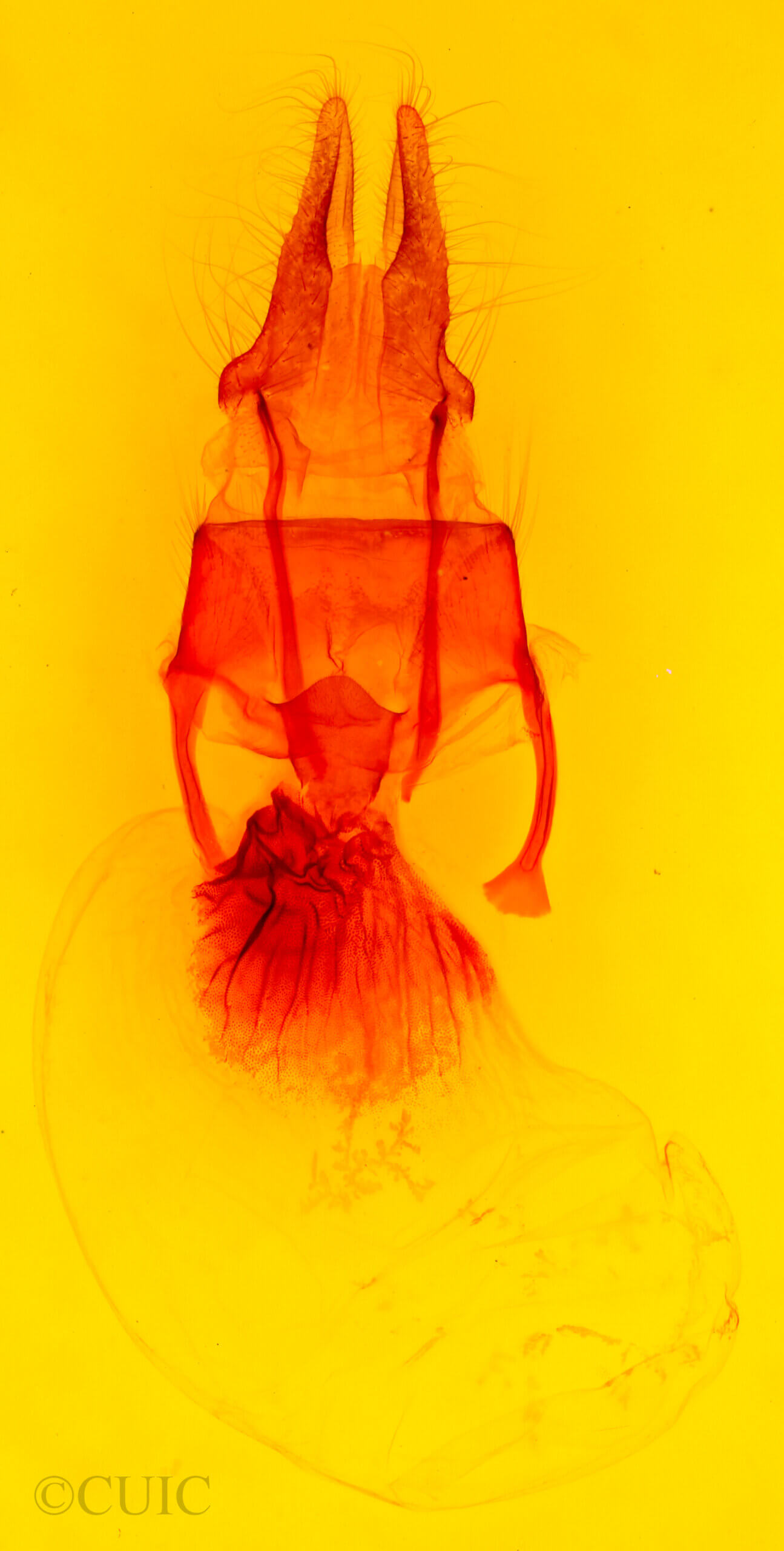 genitalia view of adult Resapamea passer