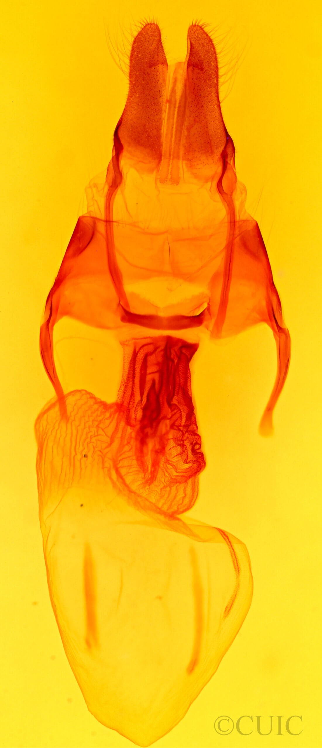 genitalia view of adult Apamea longula