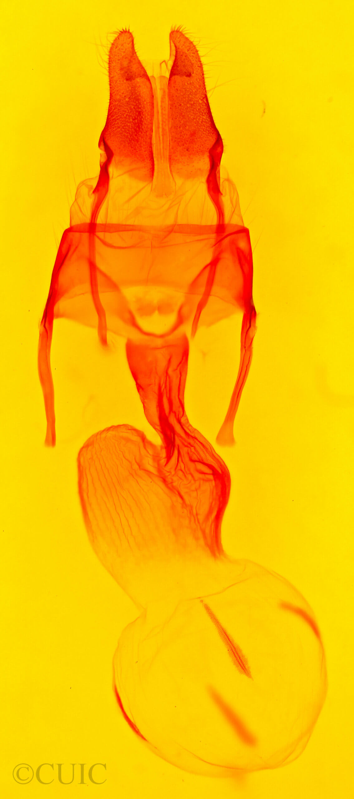 genitalia view of adult Apamea burgessi