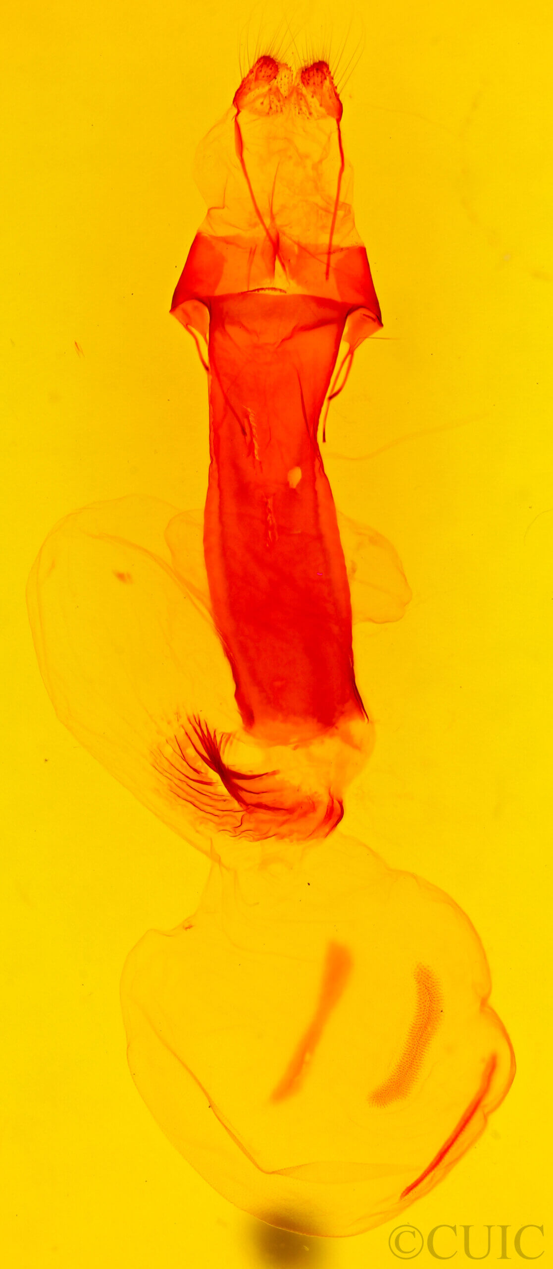 genitalia view of adult Acerra normalis