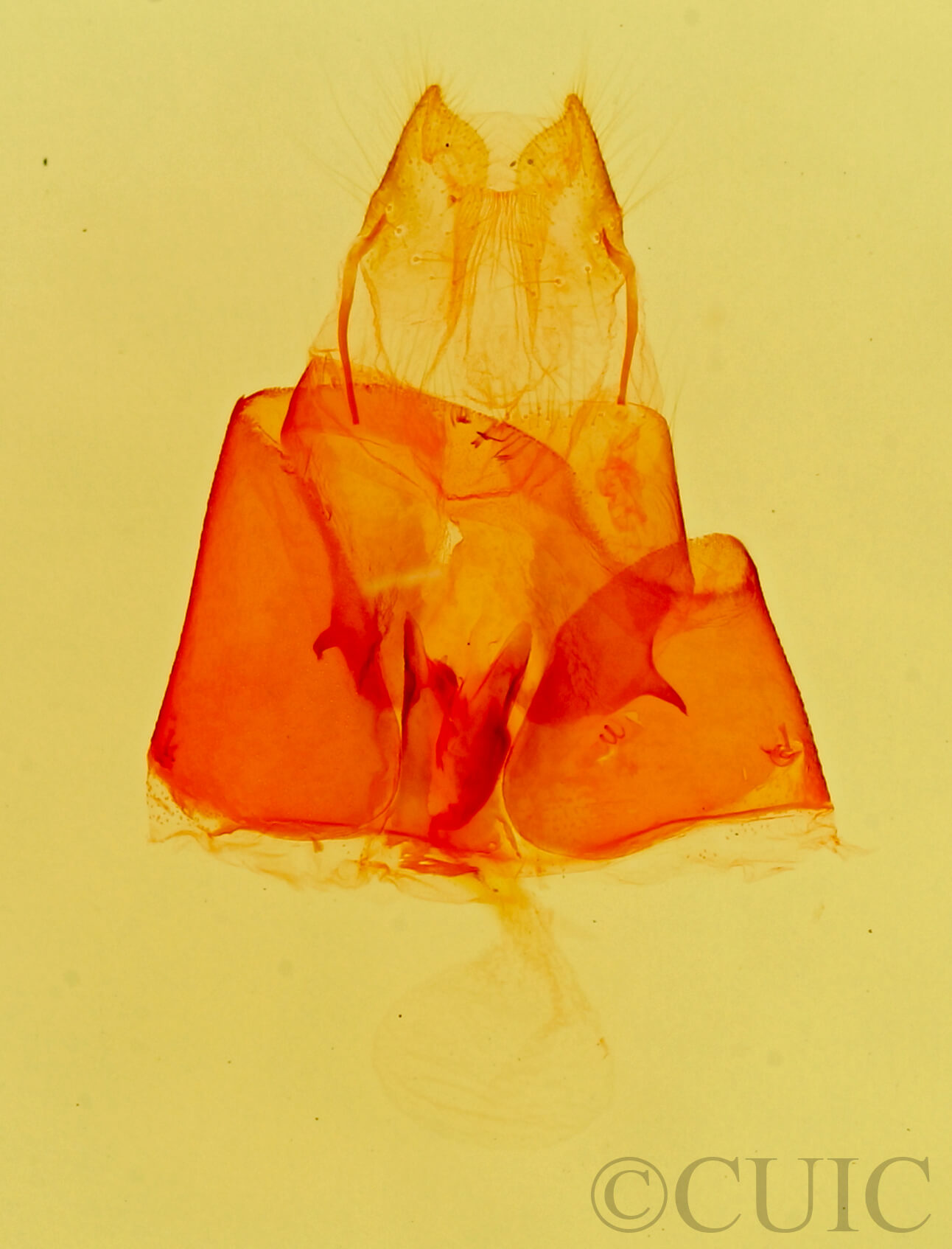 genitalia view of adult Parascotia fuliginaria