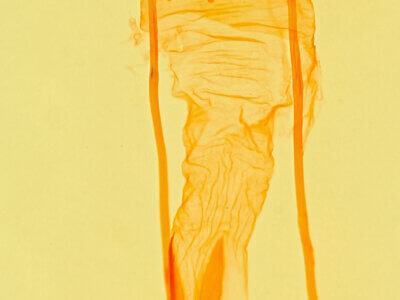 genitalia view of adult Idia aemula