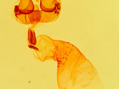 genitalia view of adult Metalectra discalis