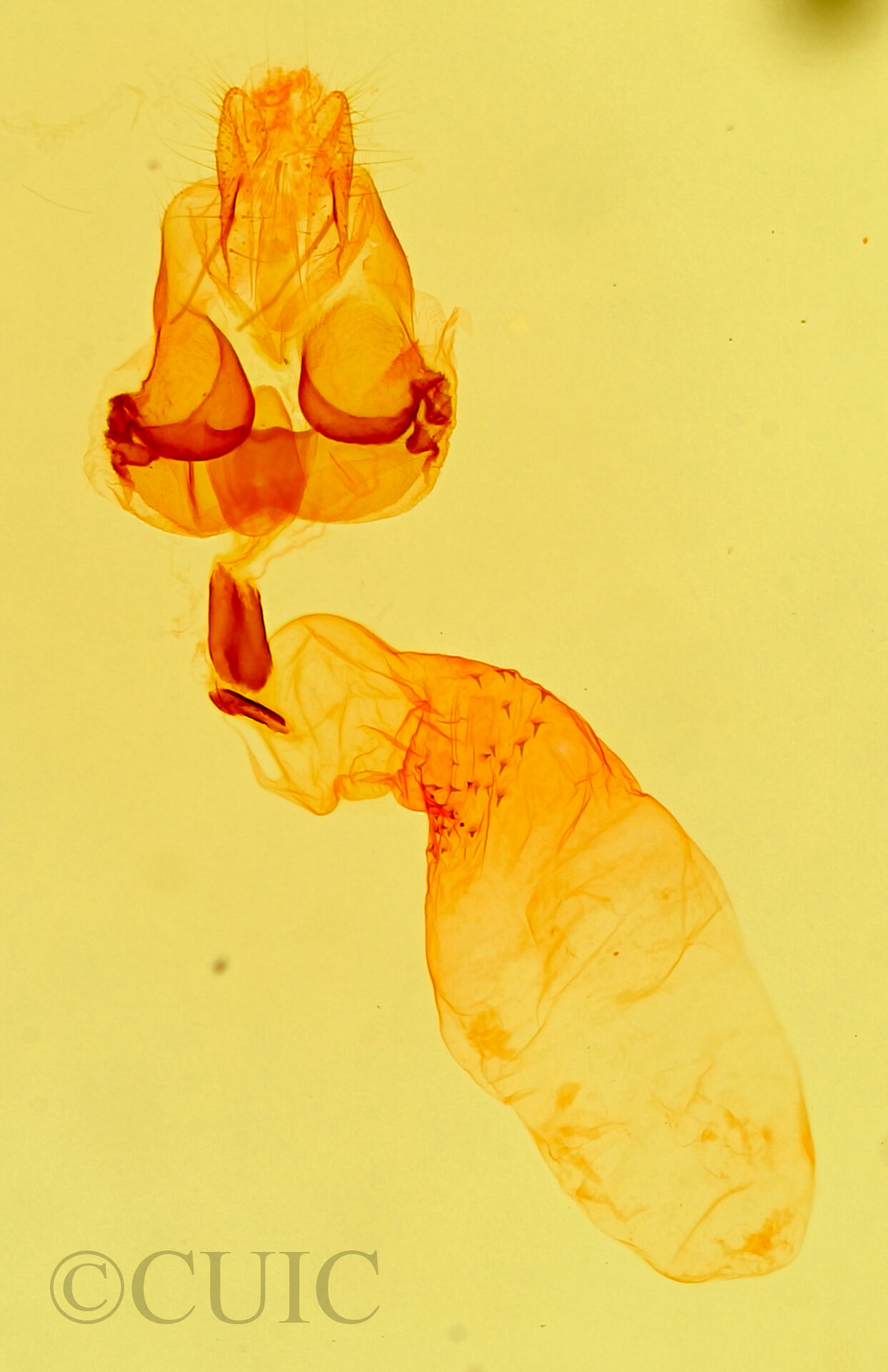 genitalia view of adult Metalectra discalis