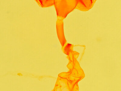 genitalia view of adult Metalectra quadrisignata