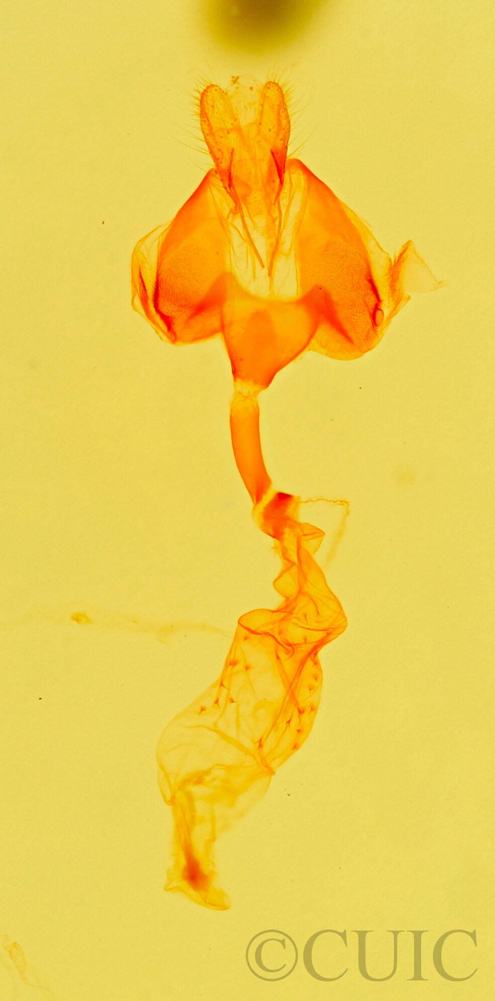 genitalia view of adult Metalectra quadrisignata